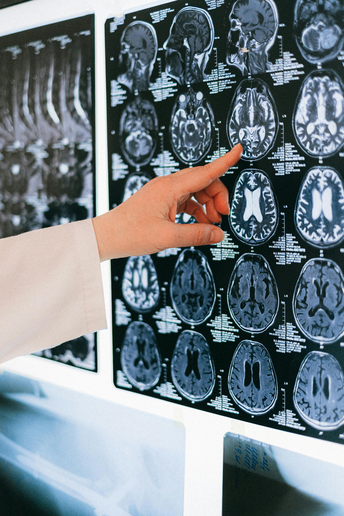 How Tunneling Research is Changing the Future of Brain Health